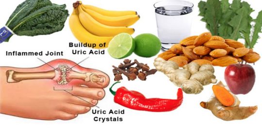 Uric Acid Level Chart For