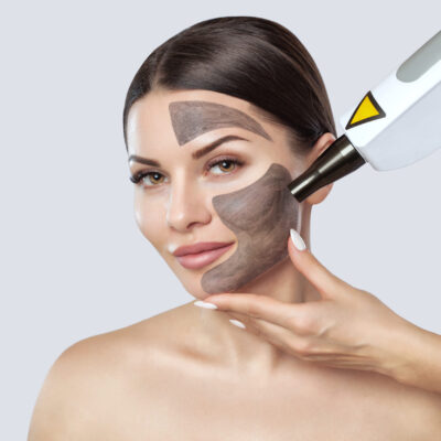 Carbon face peeling procedure in a beauty salon. Hardware cosmetology treatment.